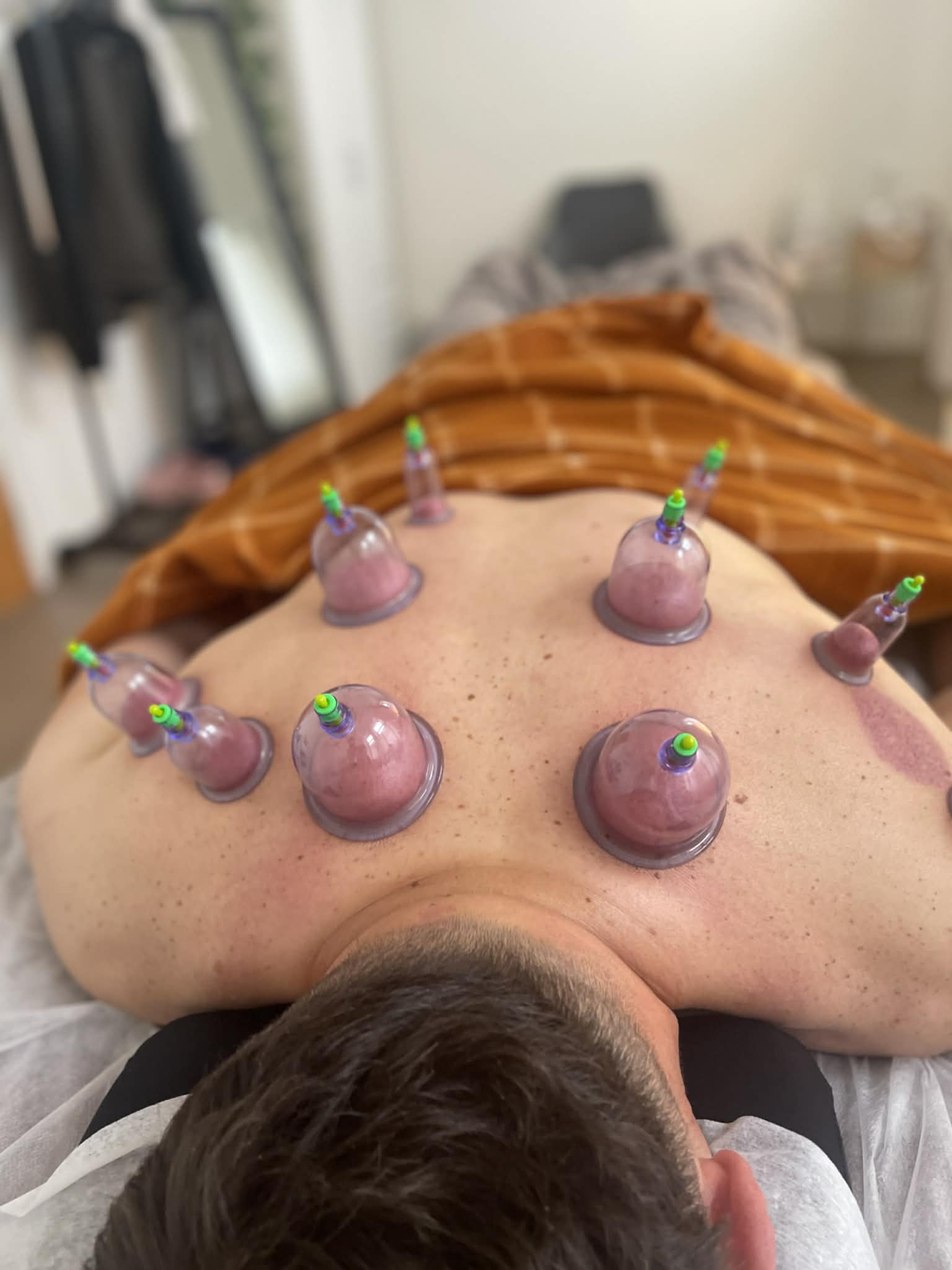 Nugaros giliųjų audinių ir trigerinių taškų masažas + vaakuminių taurių terapija