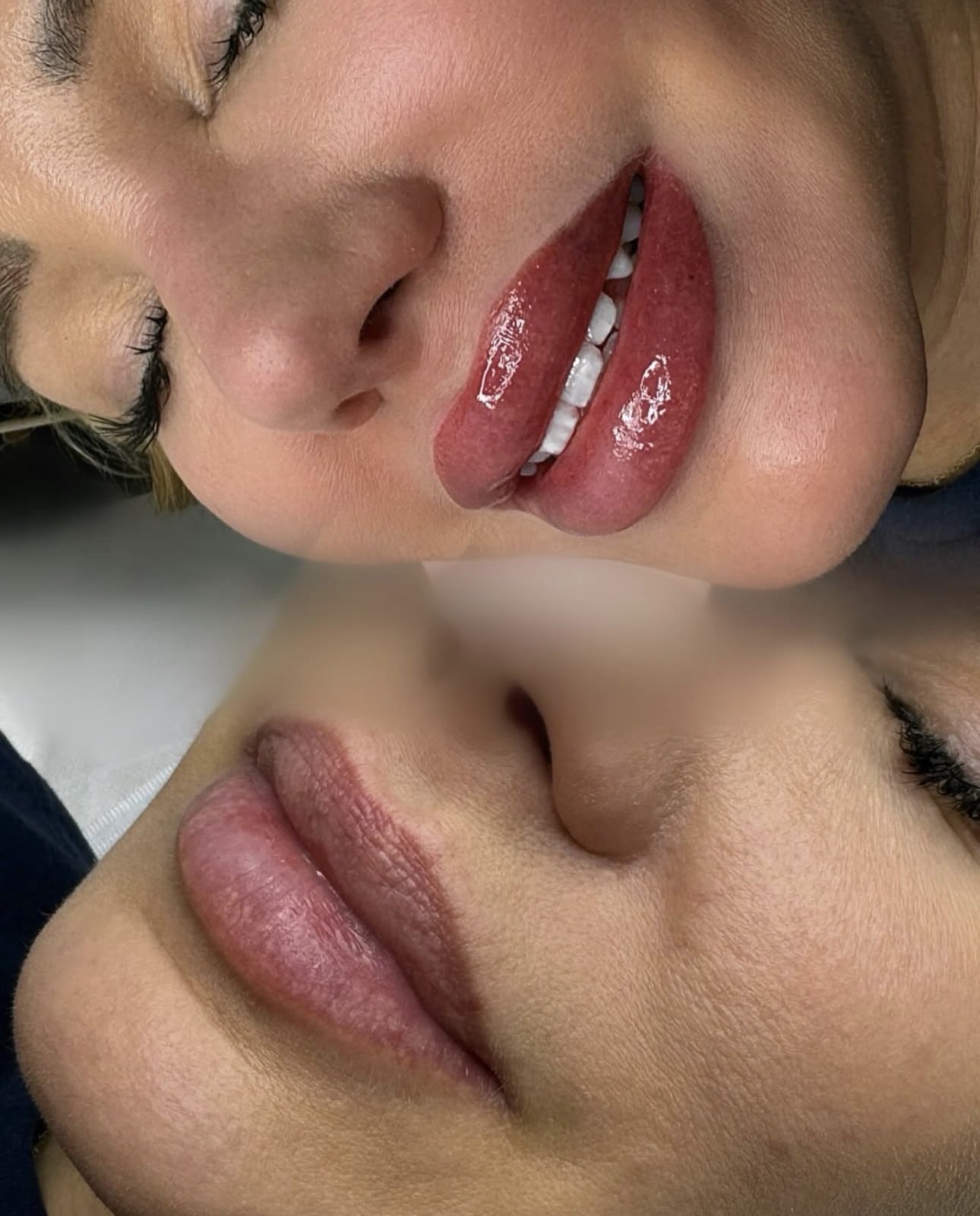 Lūpų permanentinis makiažas (Lip blush)