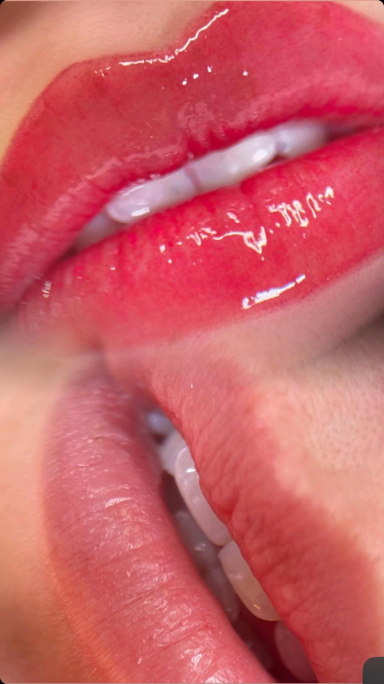 Lūpų permanentinis makiažas (Lip blush)