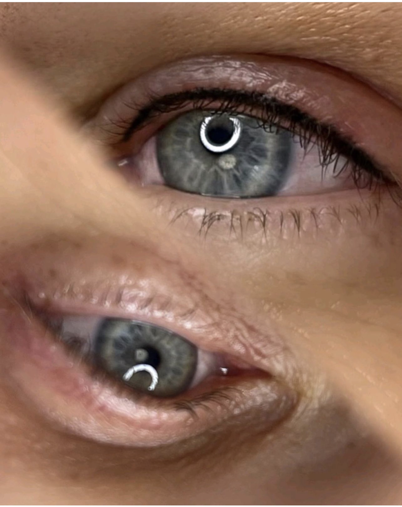 Tarpblakstieninis pravedimas(    Lash line enhancement)