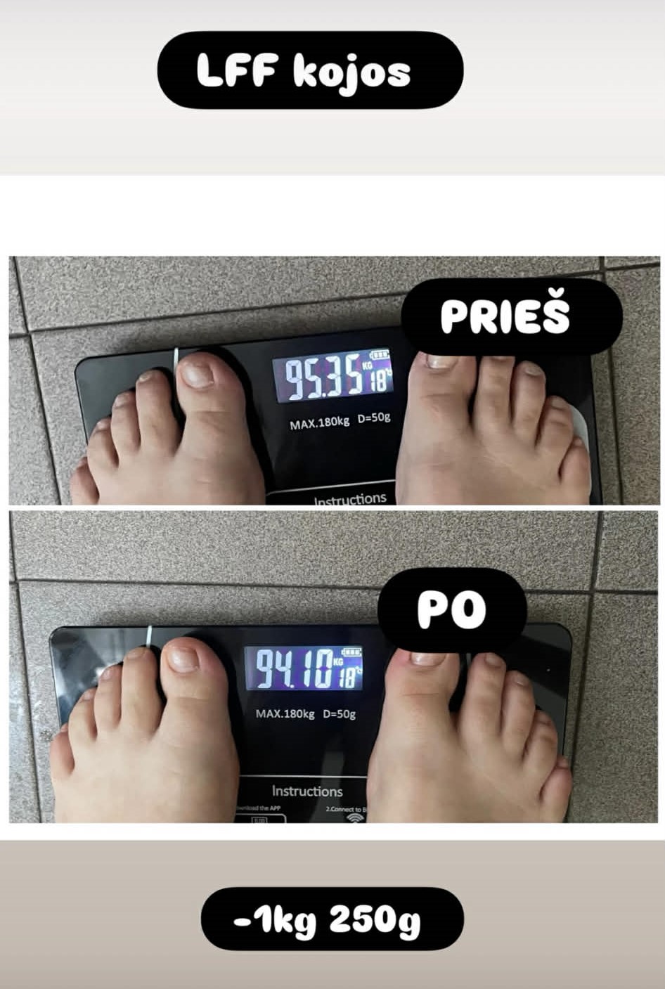 LFF (limfodrenažinis figūrą formuojantis) kojų masažas